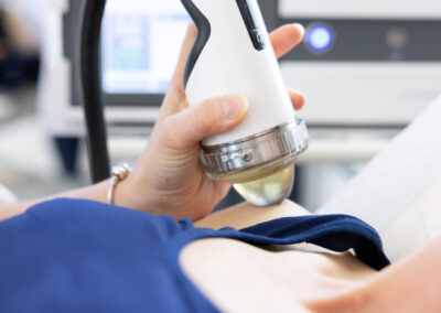 Applicazione di terapia a onde d'urto sul ginocchio durante trattamento fisioterapico strumentale